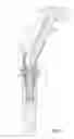 Fig. 02 - SCREW AND DRIVER TOOL FOR DENTAL PROCEDURES