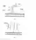 Fig. 03 - Fecal incontinence device for positioning in the lower rectum