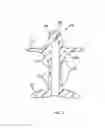 Fig. 07 - Fecal incontinence device for positioning in the lower rectum