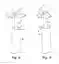 Fig. 05 - Implantable slings and anchor systems