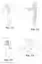 Fig. 07 - Implantable slings and anchor systems