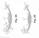 Fig. 09 - Implantable slings and anchor systems