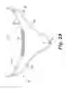 Fig. 11 - Implantable slings and anchor systems