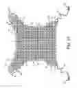 Fig. 11 - Pelvic implant and treatment method