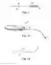 Fig. 12 - Pelvic implant and treatment method