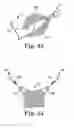 Fig. 19 - Pelvic implant and treatment method