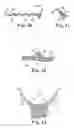 Fig. 22 - Pelvic implant and treatment method