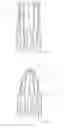 Fig. 10 - BIODEGRADABLE VASCULAR FILTER