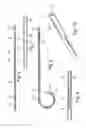 Fig. 04 - A ureteral stent