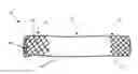 Fig. 01 - Devices for fluid flow through body passages