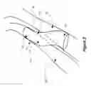Fig. 03 - Devices for fluid flow through body passages