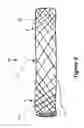 Fig. 05 - Devices for fluid flow through body passages