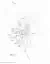 Fig. 07 - PATIENT-SPECIFIC GLENOID GUIDE AND IMPLANTS