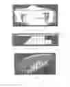 Fig. 06 - Surgically implantable knee prosthesis with captured keel