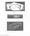 Fig. 07 - Surgically implantable knee prosthesis with captured keel