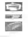 Fig. 09 - Surgically implantable knee prosthesis with captured keel