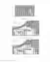 Fig. 33 - Surgically implantable knee prosthesis with captured keel