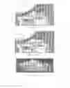 Fig. 34 - Surgically implantable knee prosthesis with captured keel