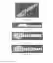 Fig. 37 - Surgically implantable knee prosthesis with captured keel