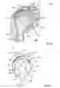Fig. 09 - Stemless shoulder implant