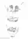 Fig. 02 - Method for preparing a patient's tibia to receive an implant