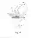 Fig. 13 - Method for preparing a patient's tibia to receive an implant