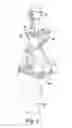 Fig. 15 - Method for preparing a patient's tibia to receive an implant