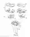 Fig. 16 - Method for preparing a patient's tibia to receive an implant