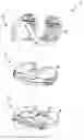 Fig. 01 - Surgical instruments for preparing a patient's tibia to receive an implant