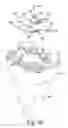 Fig. 10 - Surgical instruments for preparing a patient's tibia to receive an implant