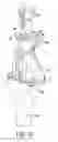 Fig. 15 - Surgical instruments for preparing a patient's tibia to receive an implant