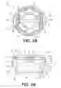 Fig. 05 - Vertebral implants and methods for installation thereof