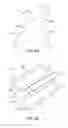Fig. 08 - NON-CIRCULAR RADIOPAQUE MARKERS AND METHODS FOR ATTACHING A MARKER TO A SCAFFOLD