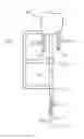 Fig. 01 - System for implanting membrane, system and method for implanting membrane and stent respectively