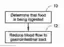 Fig. 01 - Apparatus and methods of inducing weight loss using blood flow control