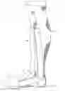 Fig. 07 - Full Contact Orthopedic Cast and Method