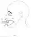 Fig. 10 - Oral Prophylactic Device