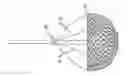 Fig. 01 - MINIMALLY INVASIVE APPARATUS AND METHOD FOR TREATING THE RETINA