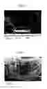 Fig. 07 - ABSORBENT ARTICLE