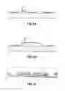 Fig. 02 - Looped layer or strip including differential attachment areas and nappy comprising such a layer