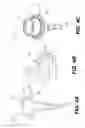 Fig. 05 - Enteral feeding device and related methods of use