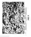 Fig. 13 - Enteral feeding device and related methods of use