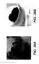 Fig. 40 - Enteral feeding device and related methods of use