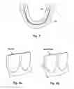 Fig. 05 - Method of, and system for smoothing teeth