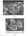 Fig. 03 - High Cleaning Silica With Low Abrasion And Method Of Making Same