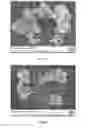 Fig. 04 - High Cleaning Silica With Low Abrasion And Method Of Making Same