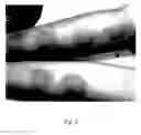 Fig. 09 - SUNLESS TANNING COMPOSITIONS COMPRISING CARAMEL