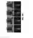 Fig. 15 - Homogenization system of drugs into biodegradable polymer: smart polymer system