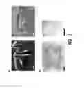 Fig. 20 - Homogenization system of drugs into biodegradable polymer: smart polymer system