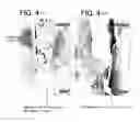 Fig. 05 - PHARMACEUTICAL COMPOSITION CAPABLE OF ACCELERATED PENETRATION INTO AFFECTED AREA